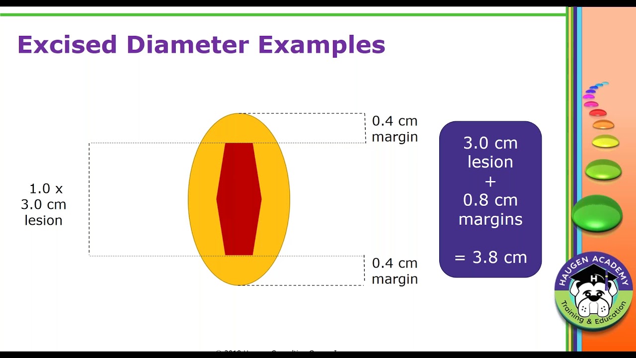 HCGTV: Webinar - Tackle Your Lesion Coding Troubles
