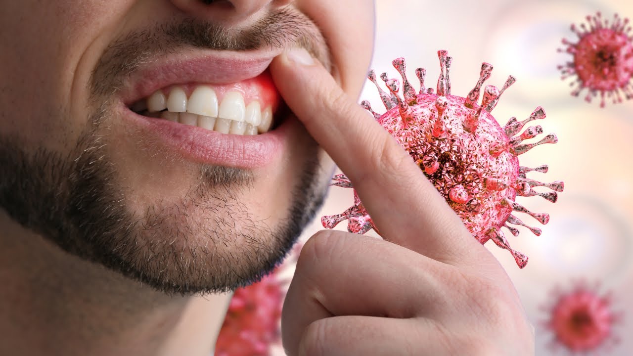 SDLE microorganisms (منال نوتز)
#saudi dental licensure examination