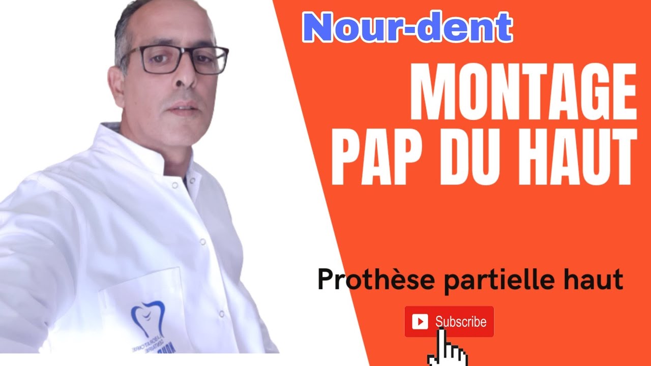 Prothèse partielle dentaire montage du haut