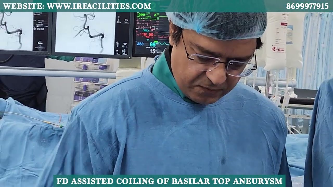 FD Assisted Coiling of Basilar Top Aneurysm | Dr. Sandeep Sharma | IRFACILITIES