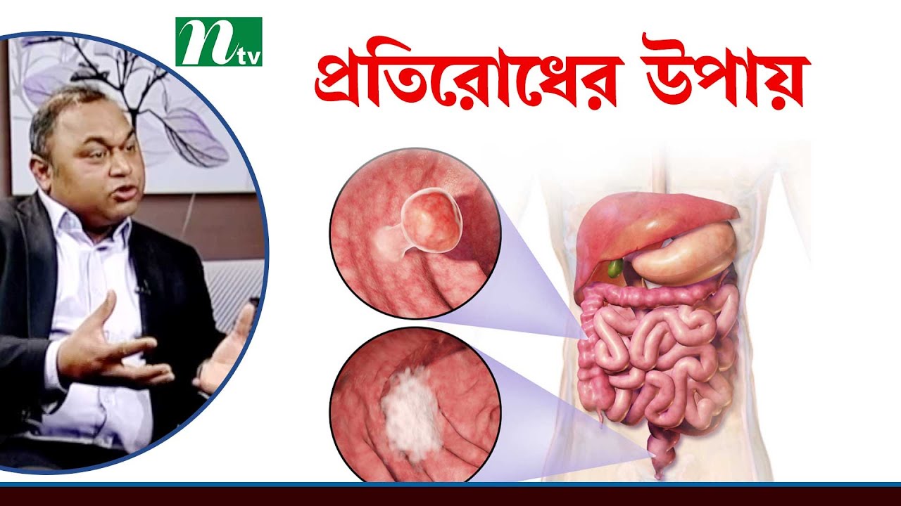 Health Show | কোলন ক্যানসারের চিকিৎসা ও প্রতিরোধের উপায়  | Colon Cancer | Shastho Protidin