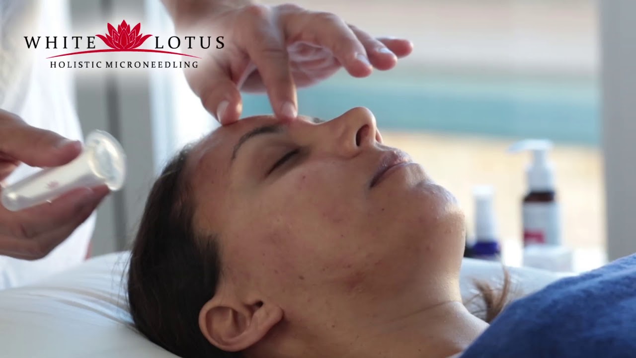 Schr&ouml;pfen Gesichts K&ouml;rper Therapie