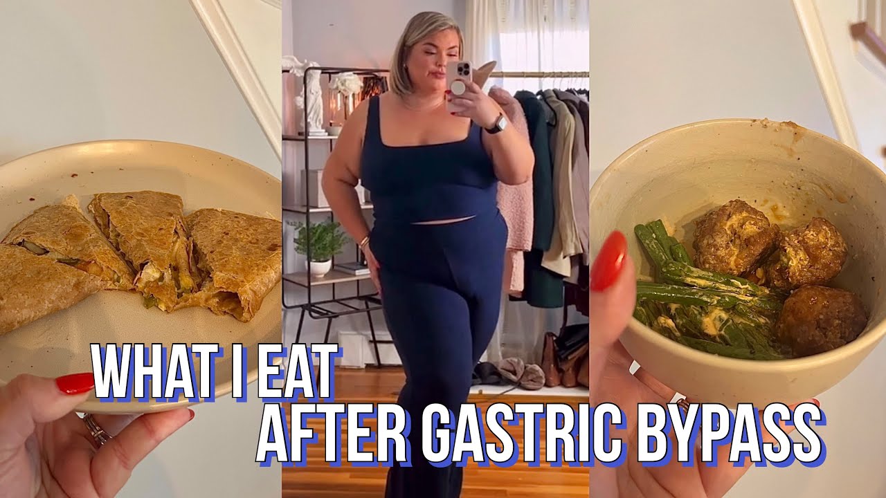 WHAT I EAT IN A DAY AFTER GASTRIC BYPASS + EMOTIONAL EATING CHATS