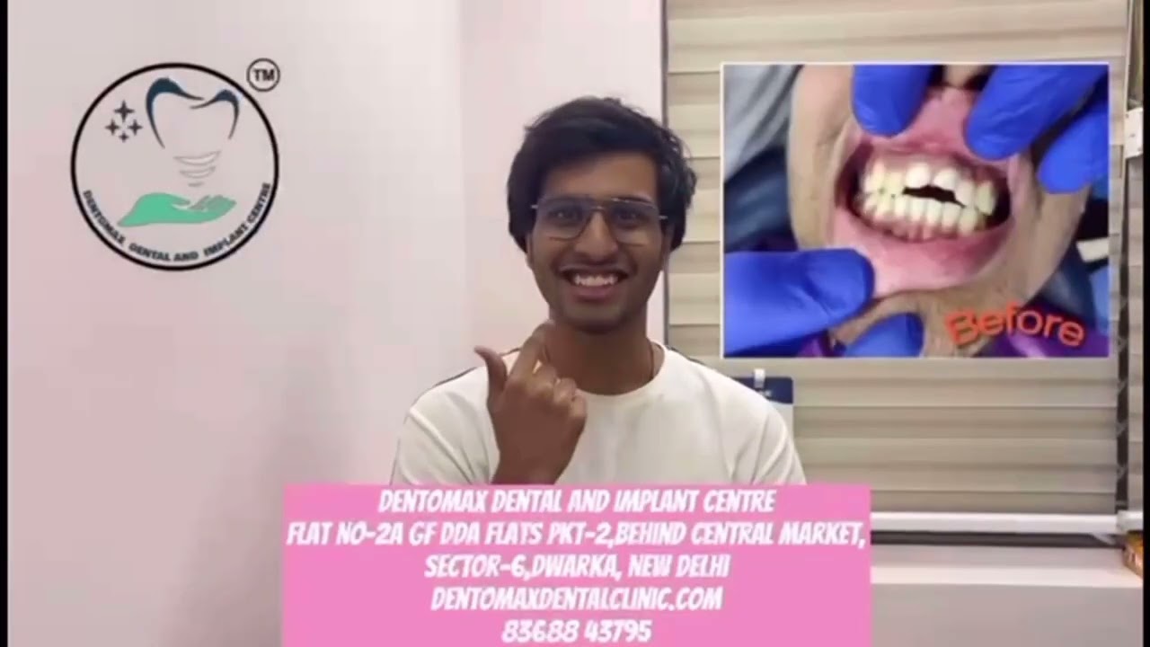 Video for testimonial for best dental doctor in dwarka