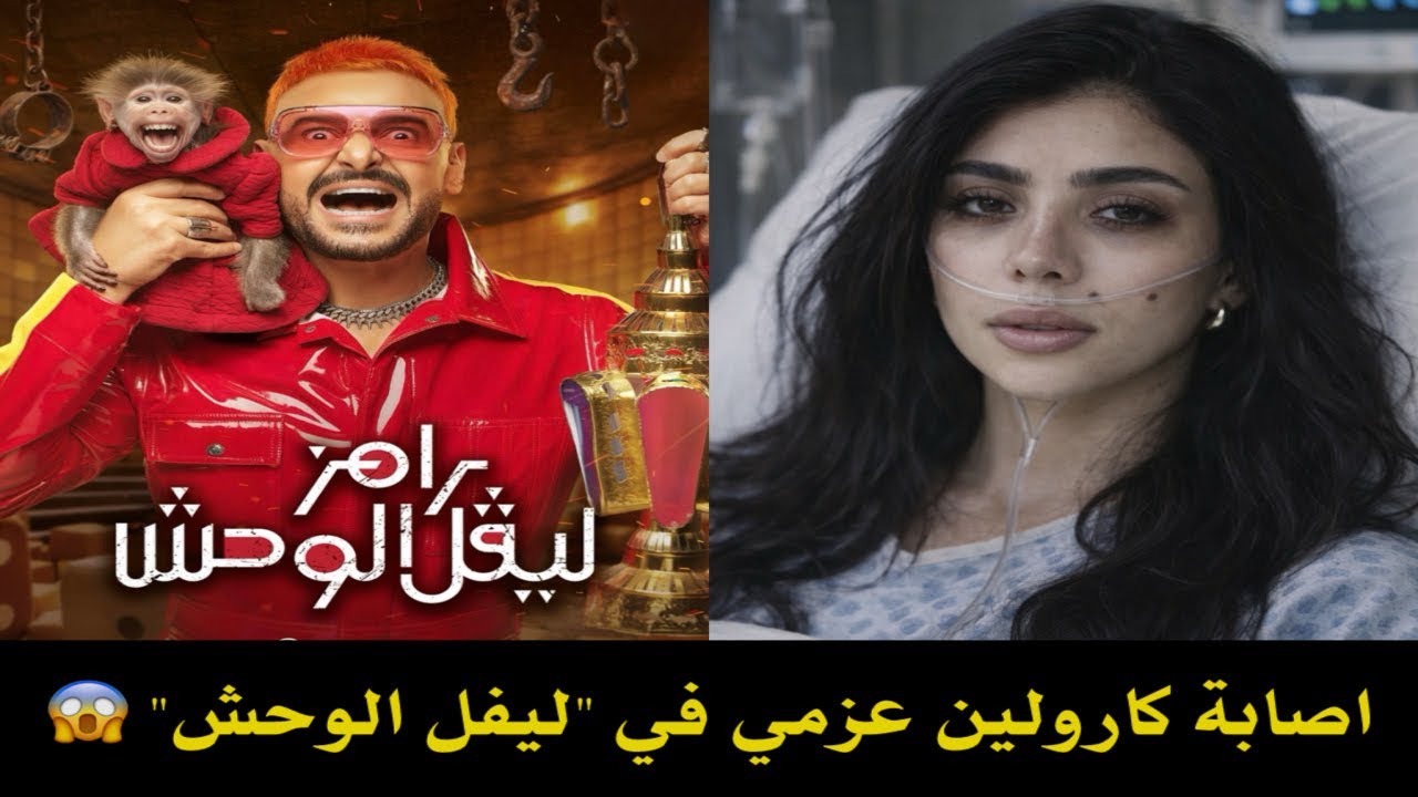 حالتها خطـ.ـيرة جداً .. نقل كارولين عزمي للمستشفي بعد اصابتها في كواليس برنامج رامز ليفل الوحش 😱