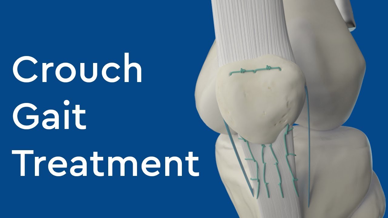 What is Crouch Gait Treatment