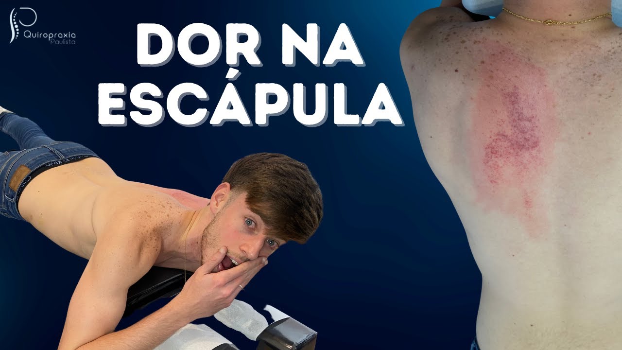 LIBERAÇÃO DE ESCÁPULA | CONSULTA DE QUIROPRAXIA