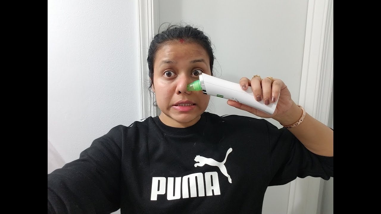 Vacuum pore Cleaner | unboxing and full review | Best Multifuctional Blackhead removal