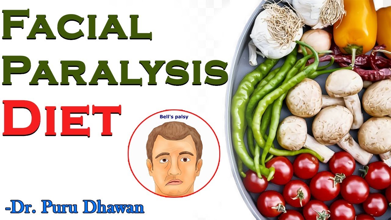 Facial Paralysis Diet