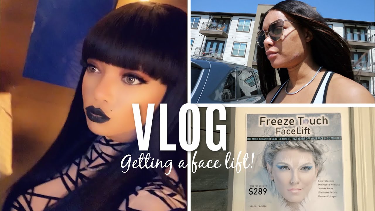 VLOG | Battling Acne + Skin Tightening after Facial Contouring (Bad Skin Week) | Peyton Charles