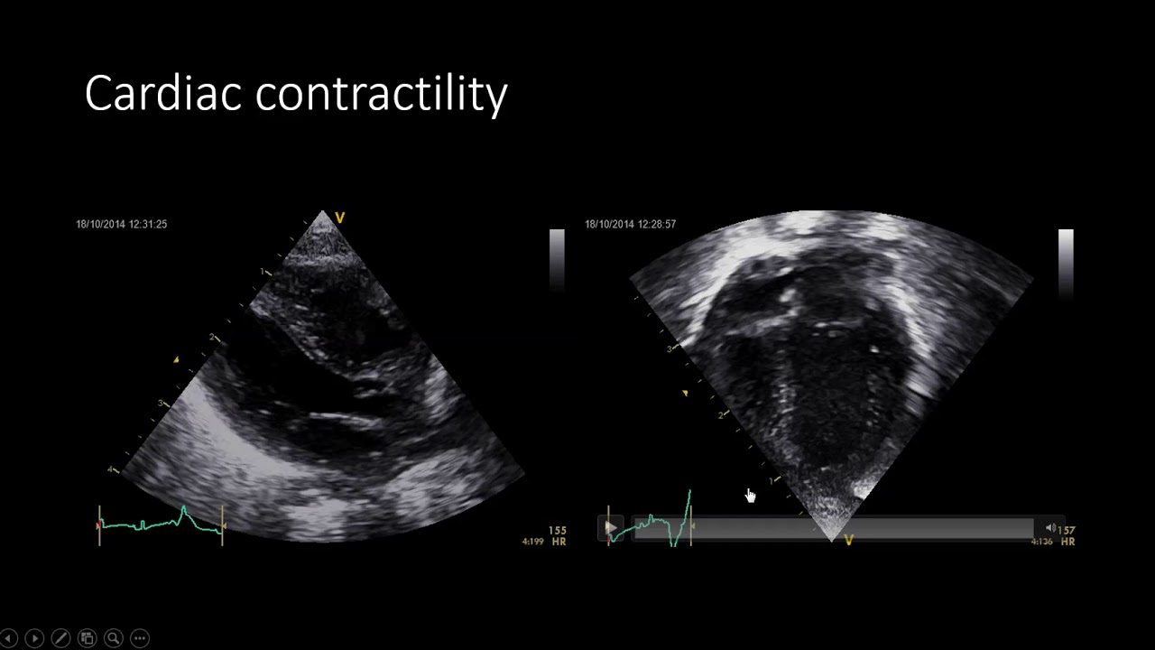 Cardiac function assessment