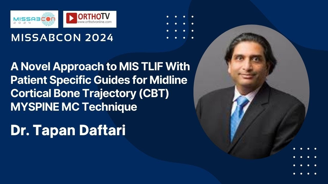 MISSABCON 2024: Novel MIS TLIF with Patient-Specific Guides (MYSPINE MC) &ndash; Dr. Tapan Daftari