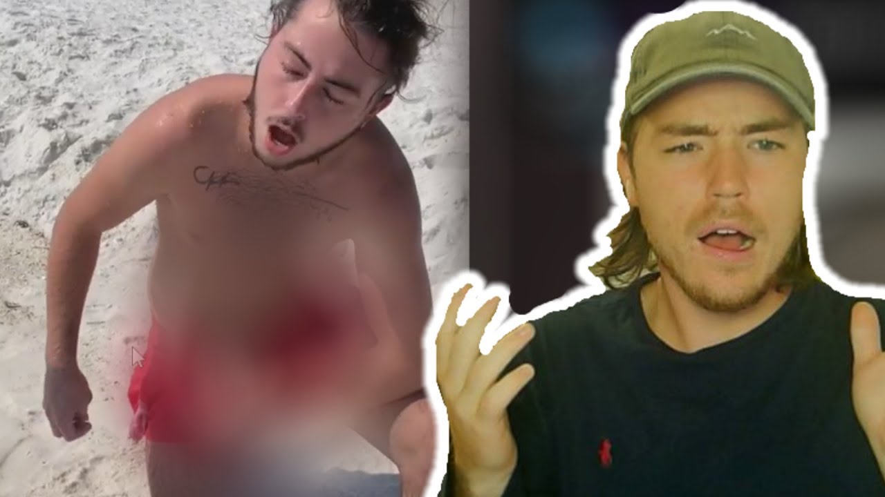 THE FISH ATTACKED HIM WHERE?!?