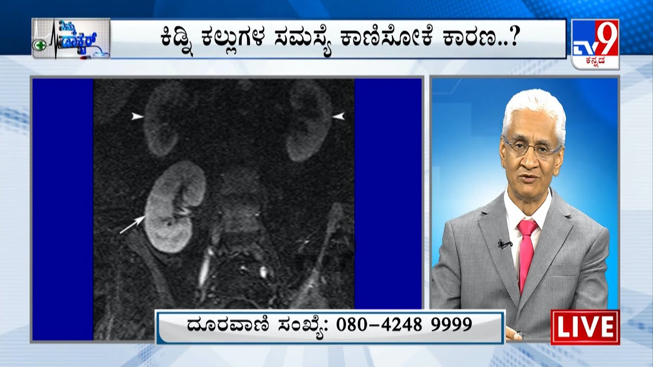 Nimma Doctor | Treatment For Kidney Stones | NU Hospitals (West) | 27-06-2022