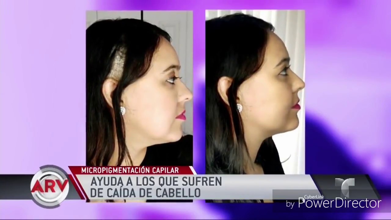 micropigmentacion capilar mujeres HD