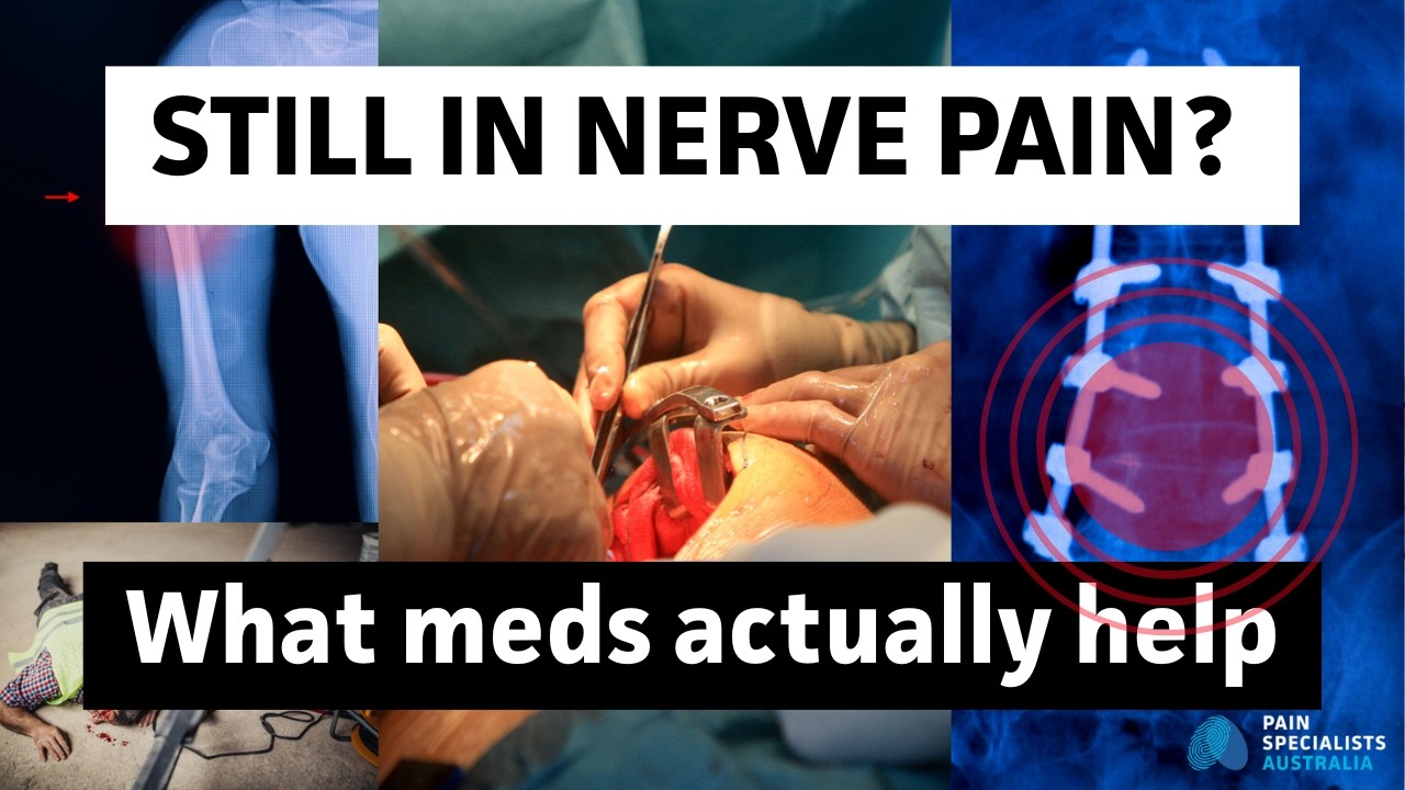 Nerve Pain Meds Explained by Experts: What Actually Works - The Pain Diaries Podcast