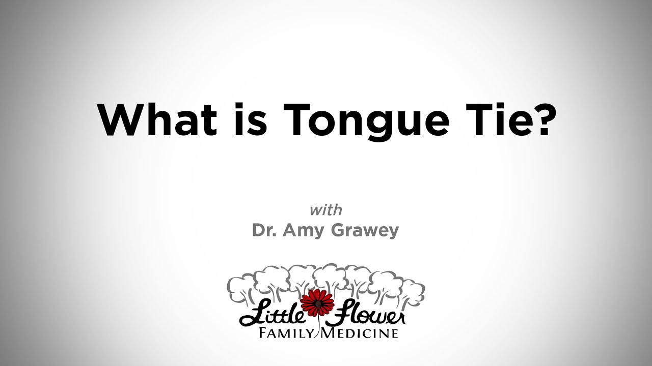 What is Tongue Tie?