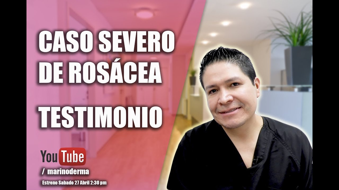 RÓSACEA CASO SEVERO Y TESTIMONIO Dr Marino Dermatologo