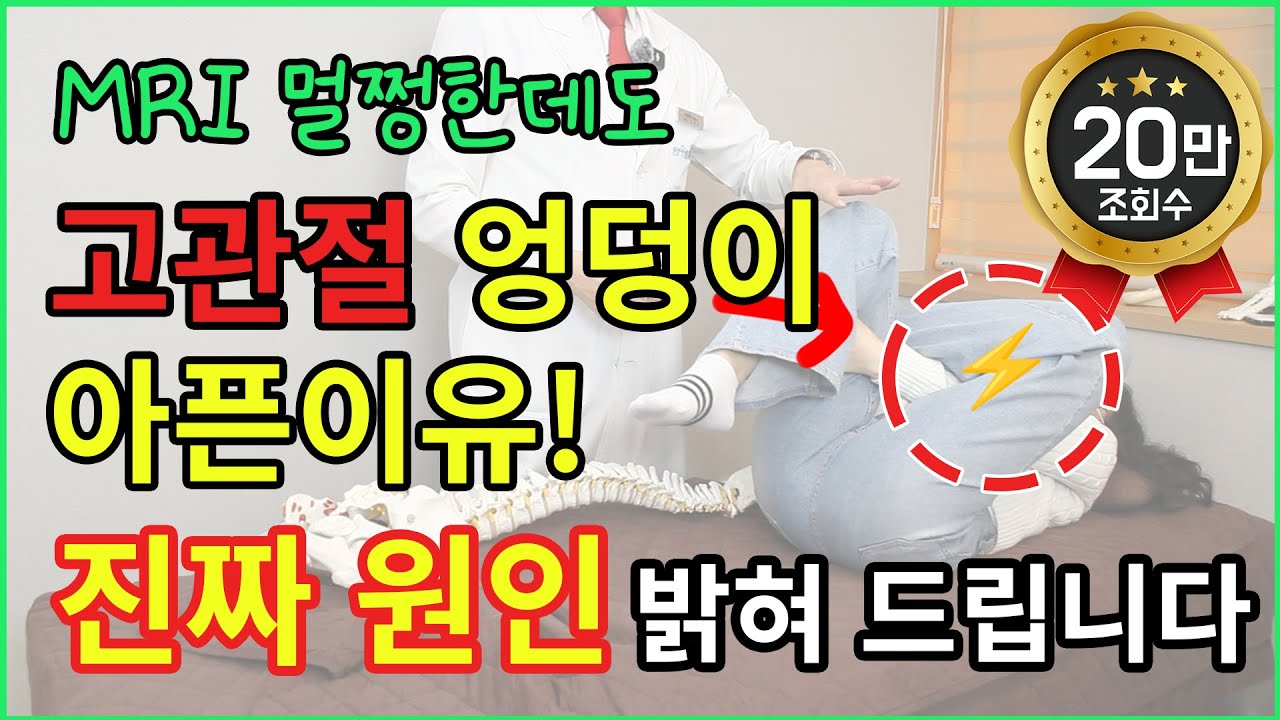 고관절·엉덩이 통증, 병원도 MRI도 못 잡는 이유! (시청자 질문 8가지로 정리)