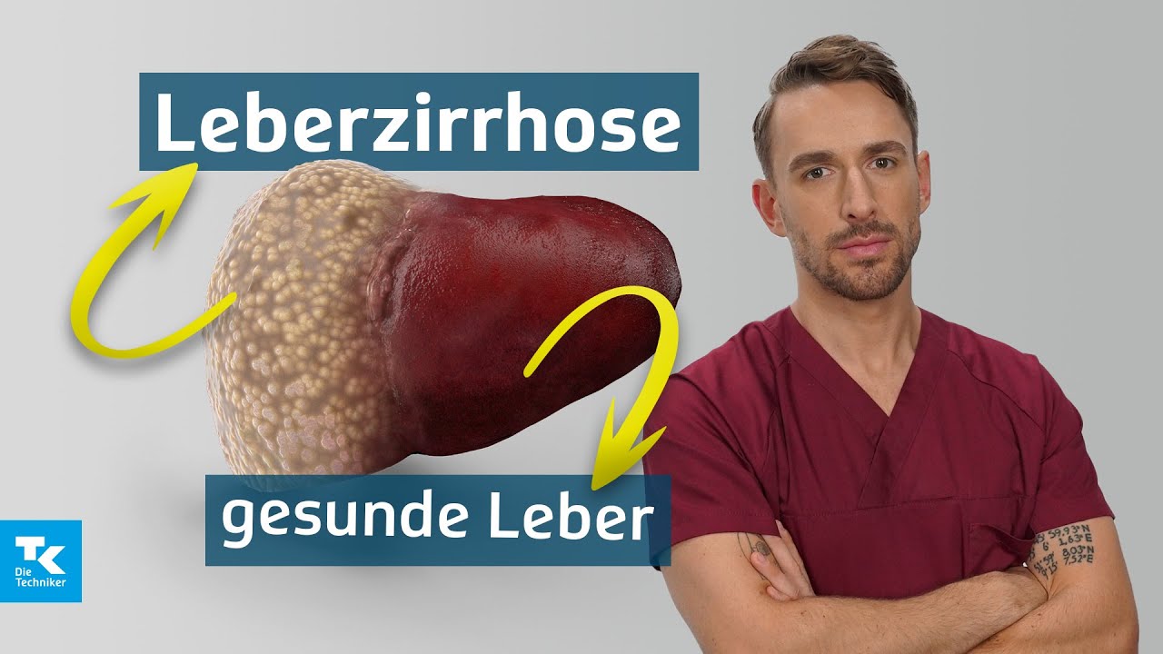 Leberzirrhose verstehen: Ursachen, Symptome, Diagnose & Therapie | DocTommy