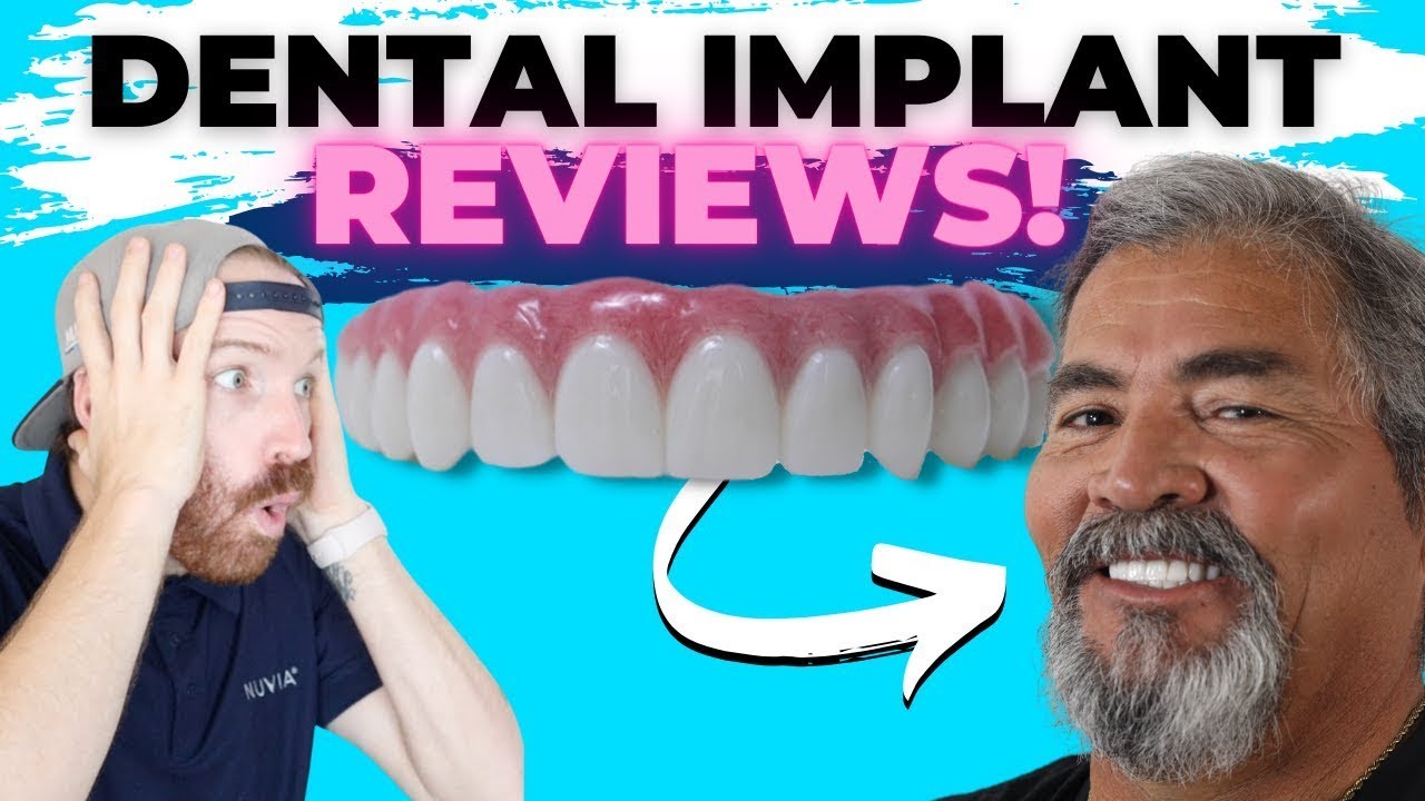 Patients Review Their Dental Implant Experience