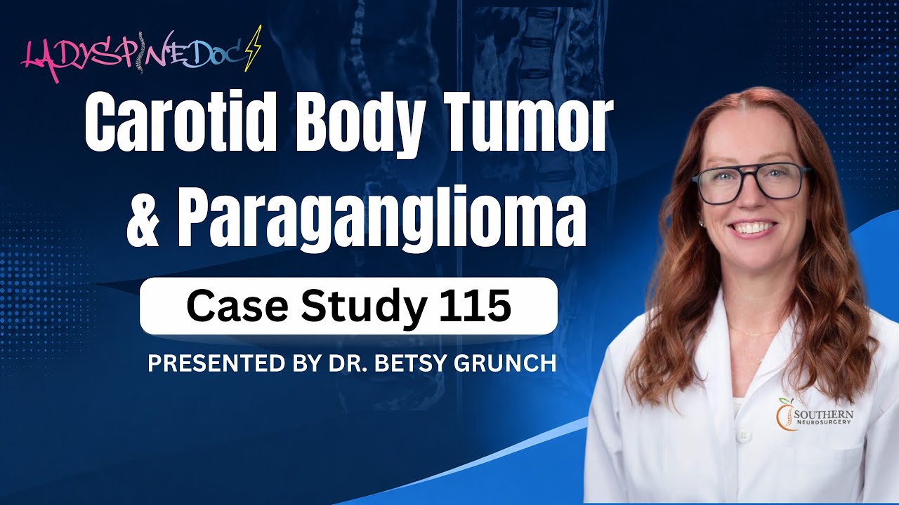 Case study 115 - Carotid Body Tumor / Paraganglioma EXPLAINED by Dr. Grunch, Neurosurgeon