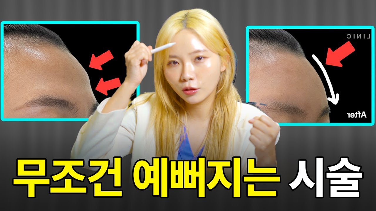 [ENG SUB] 무조건 '이마필러' 하세요. 바로 예뻐집니다,Get Forehead Filler Now! Instant Beauty