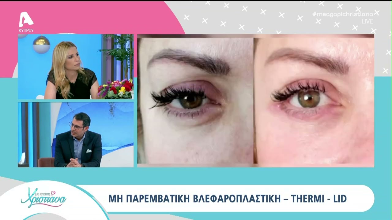 Βλεφαροπλαστική & Κρυμμένο Lifting #plasticsurgeon #quickfixdoctor #plasticsurgery