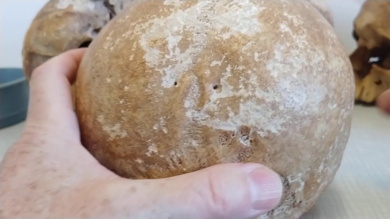 Anatomia w pigułce. Połączenia szkieletu osiowego. Podstawy.
