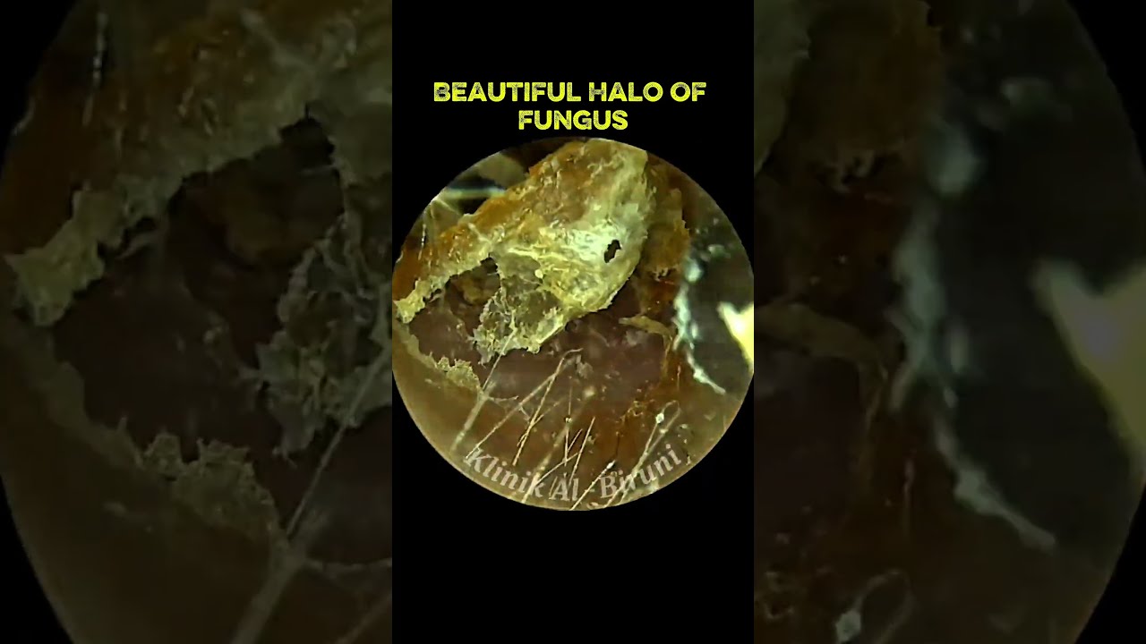 Beautiful Halo Of Fungus