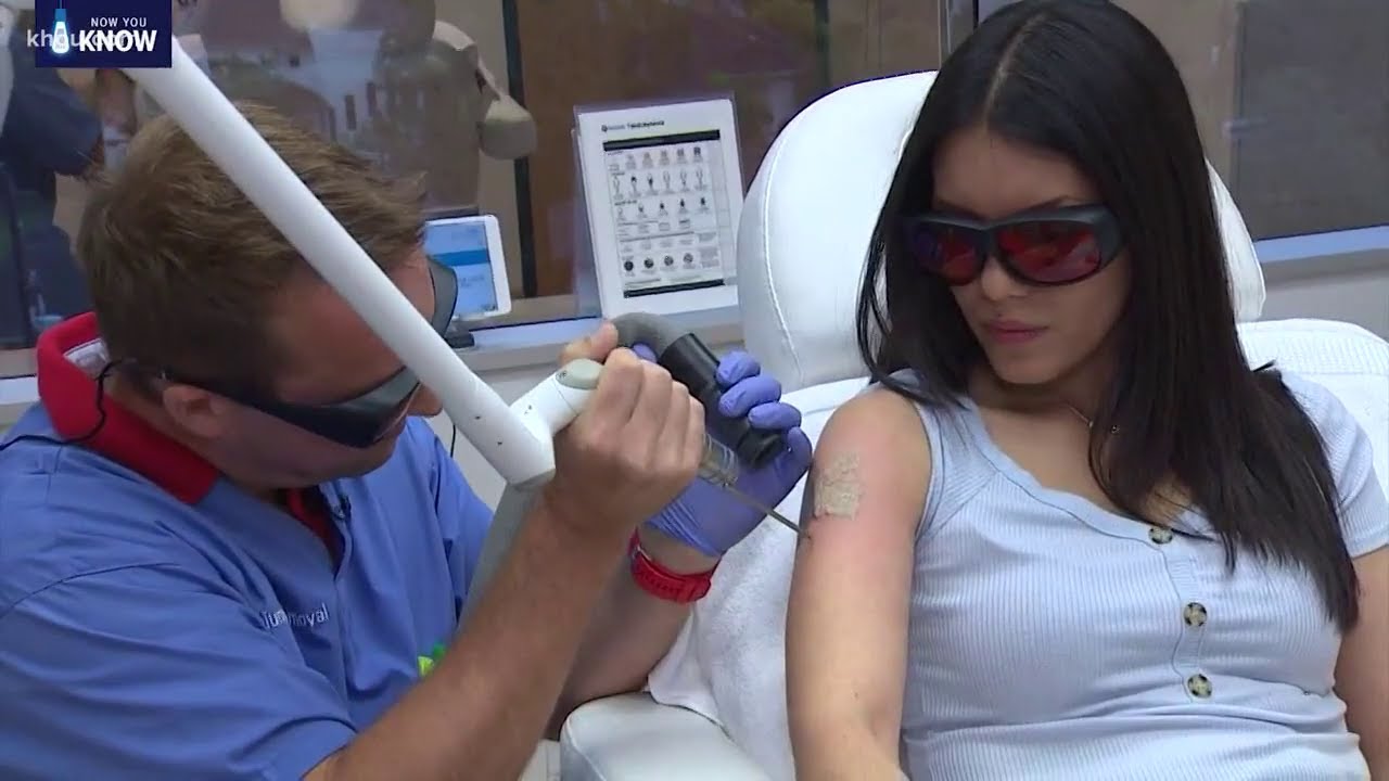 Premium Tattoo Removal on KHOU11