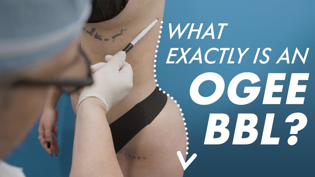 The OGEE BBL - My Brazilian Butt Lift Secret