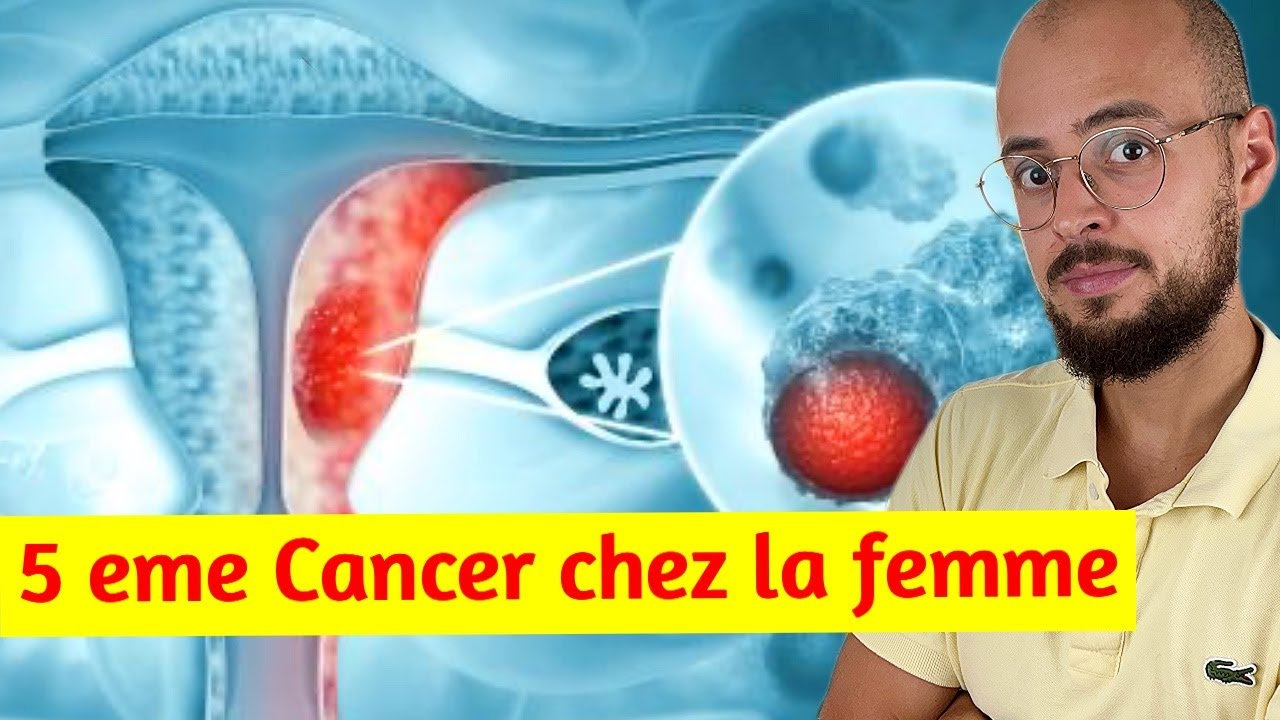 Cancer de l'endomètre : le symptôme qu'il faut ABSOLUMENT connaitre !
