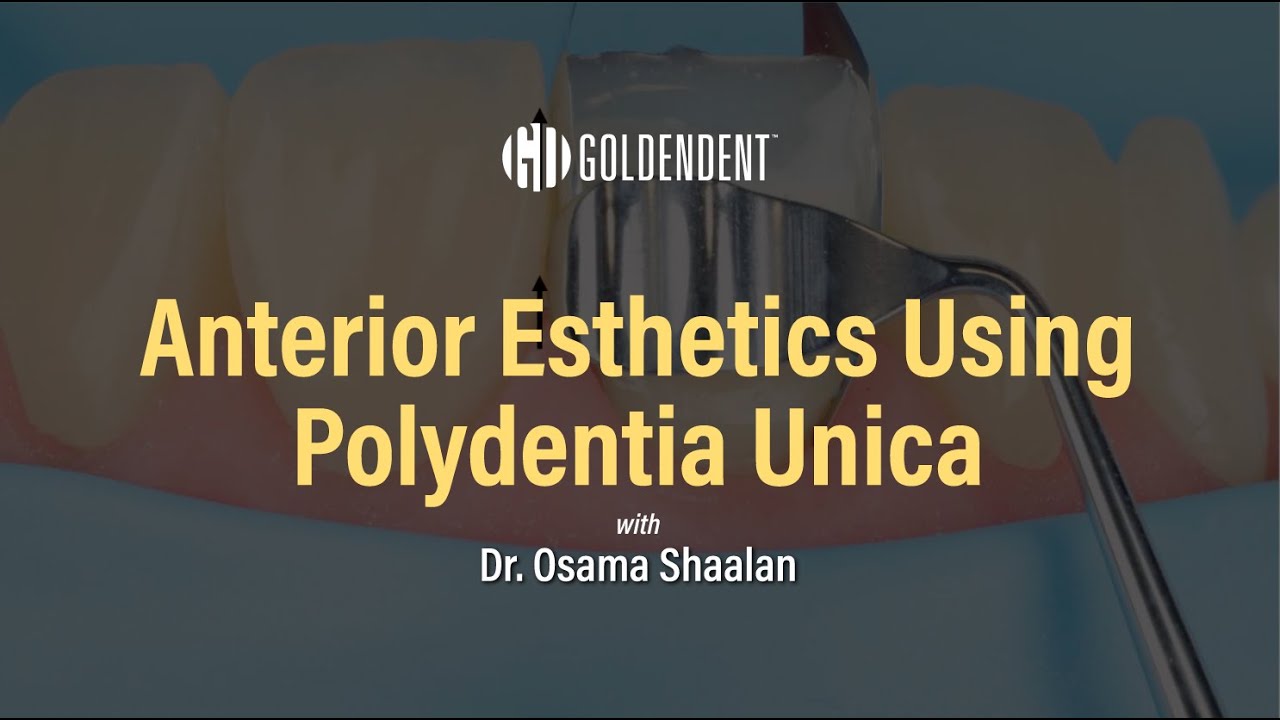 Overview of Polydentia Unica Proximal Anterior Matrix System by Dr. Osama Shalaan