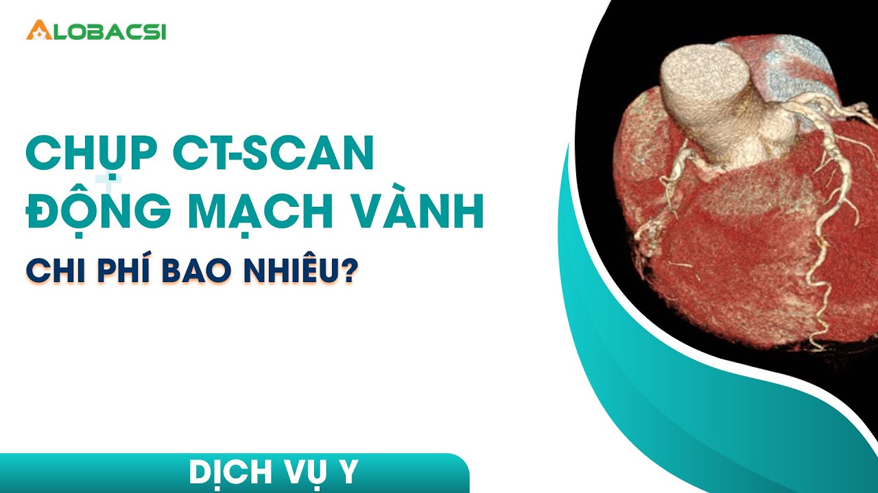 Chụp CT-scan động mạch vành chi phí bao nhiêu?