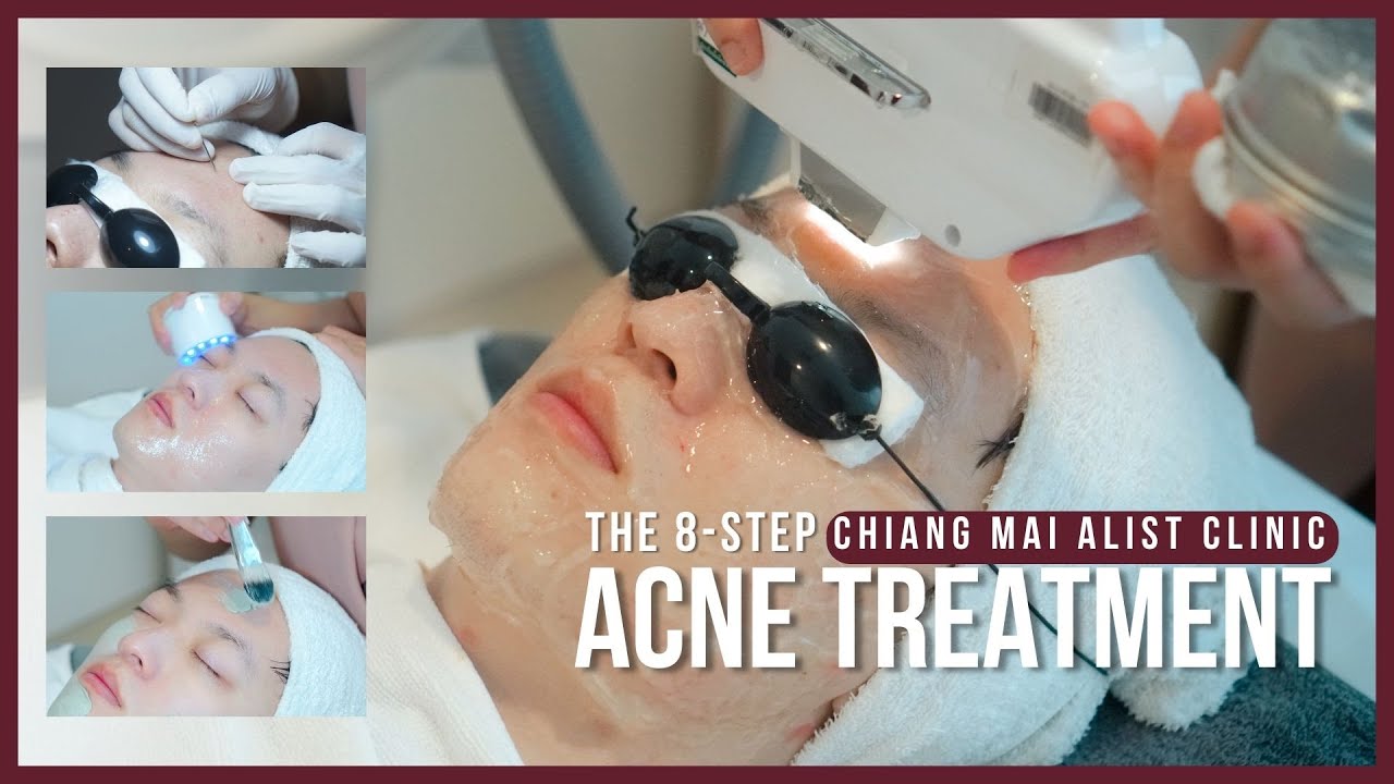 ACNE TREATMENT | Chiang Mai ALIST Clinic