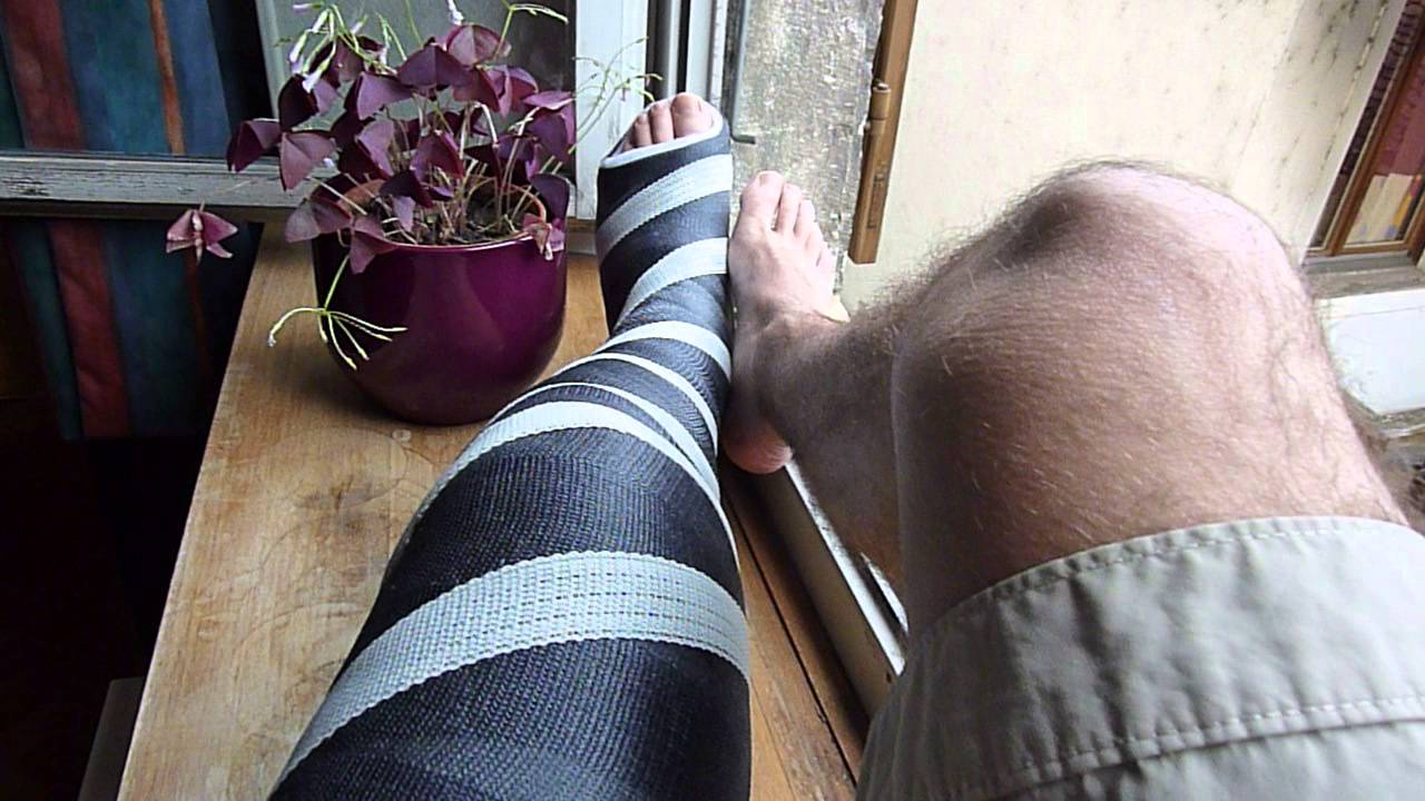 Long leg cast / black & white # 1