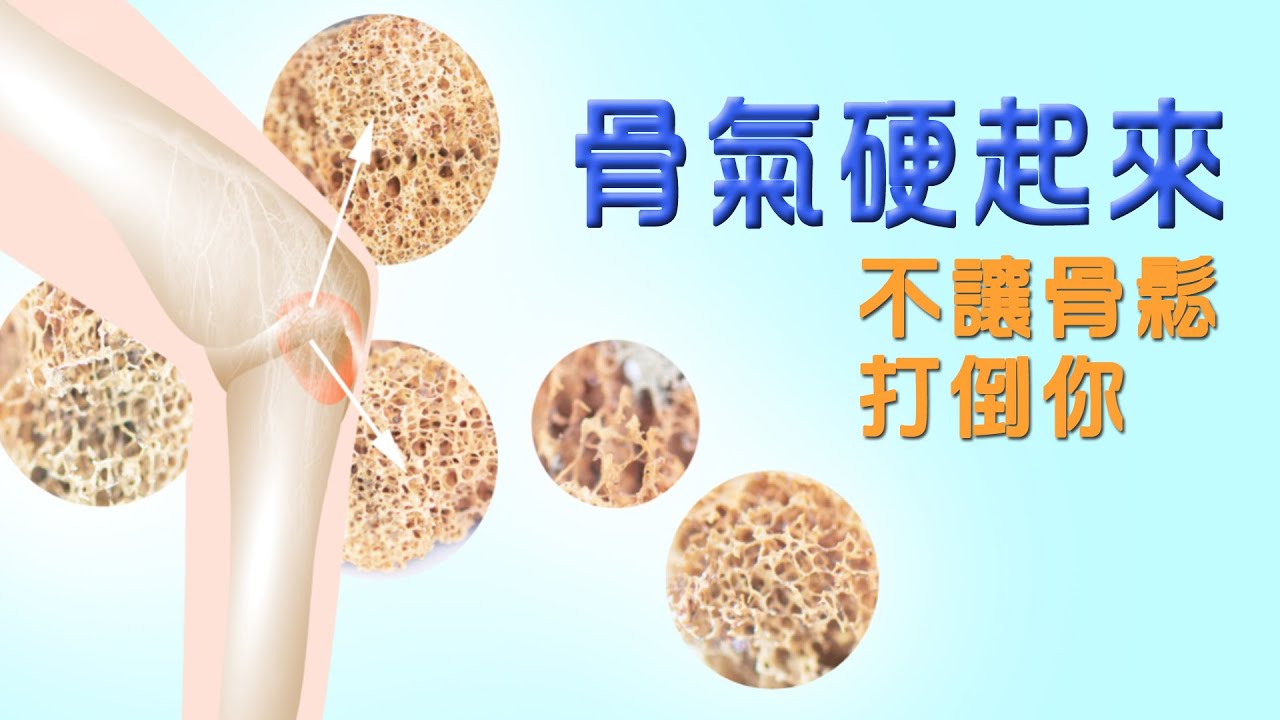骨質疏鬆的治療和保養 【大愛醫生館】