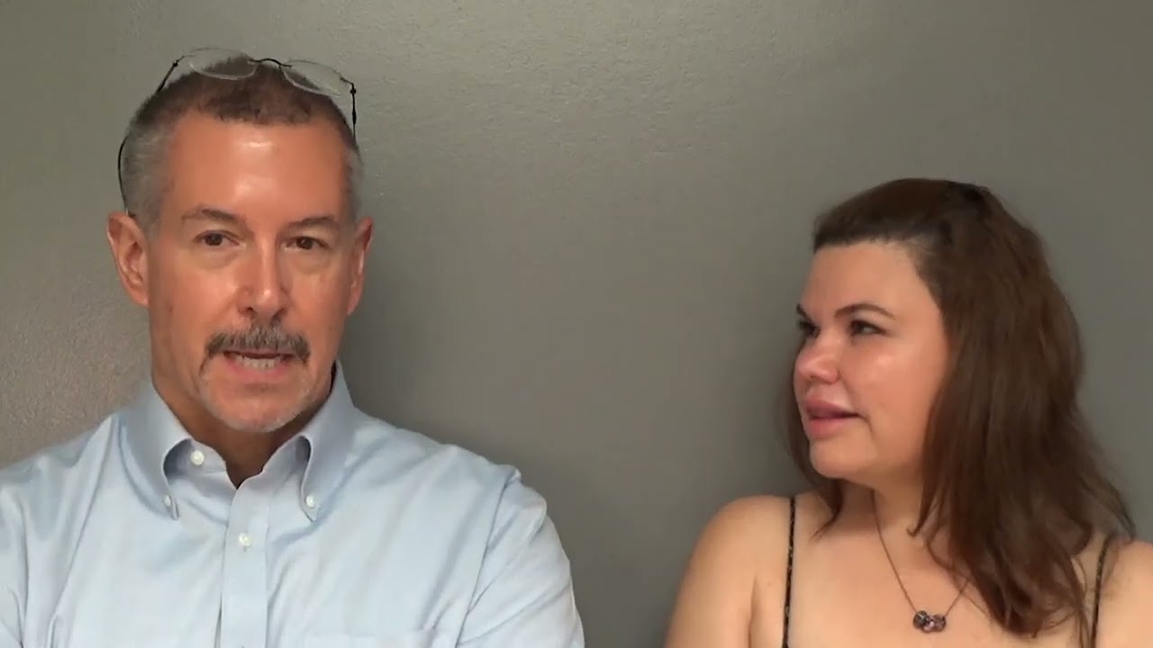 Natural hair transplant results in 60ish year old with gray hair at 5 years by Dr. Lindsey in McLean