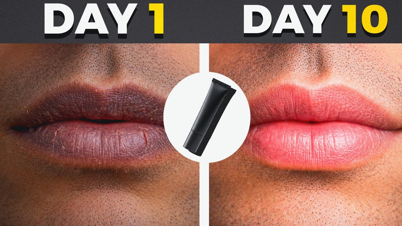 Turn Your Dark Lips Into Pink Smooth Lips (Full Guide) Get Rid of Dark Lips