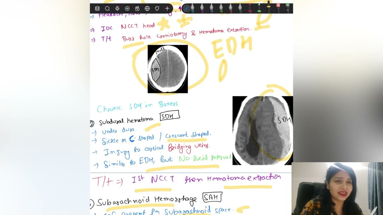 Lecture on stroke| Management of stroke #mbbs #fmge #neet #neetpg #doctor #neurology #lecture #study