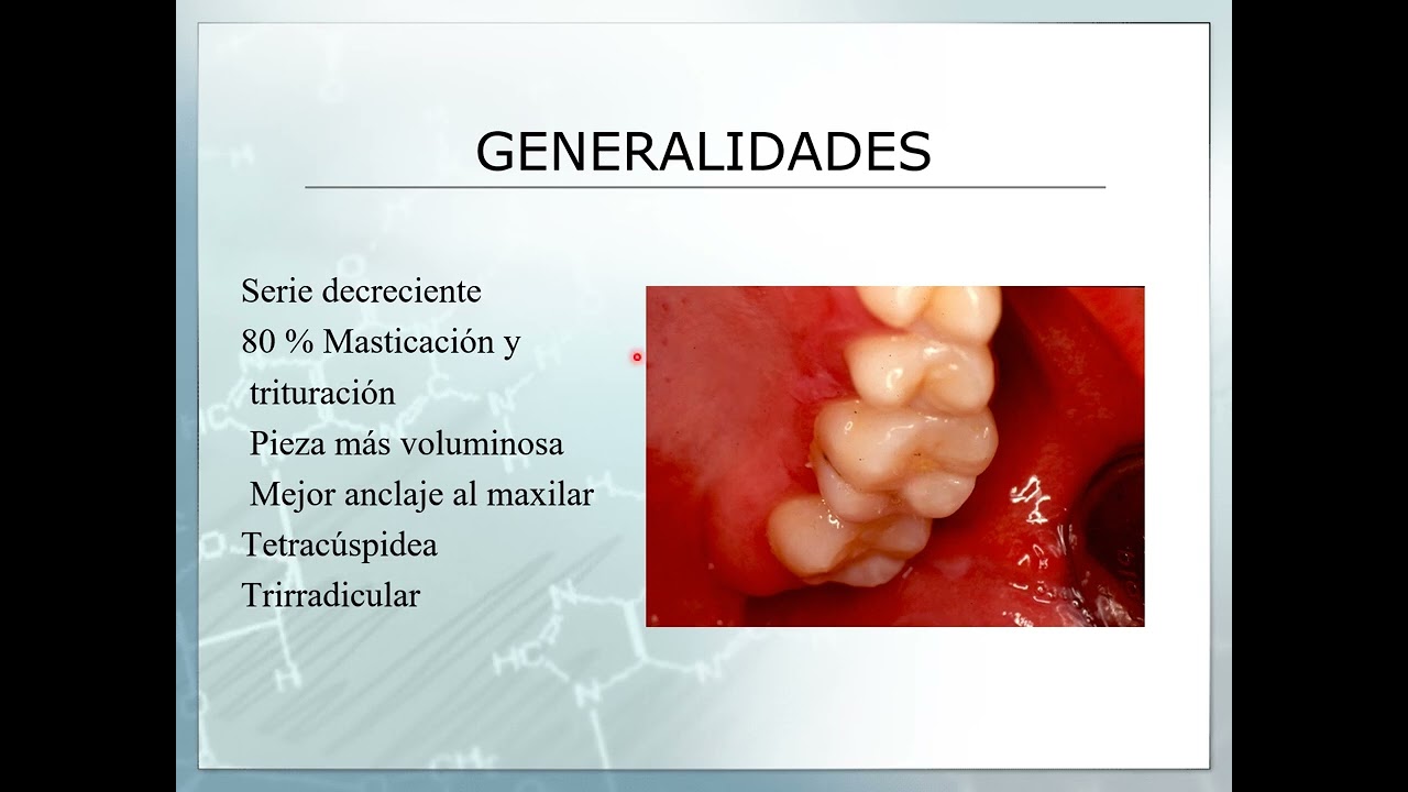 PRIMER MOLAR SUPERIOR