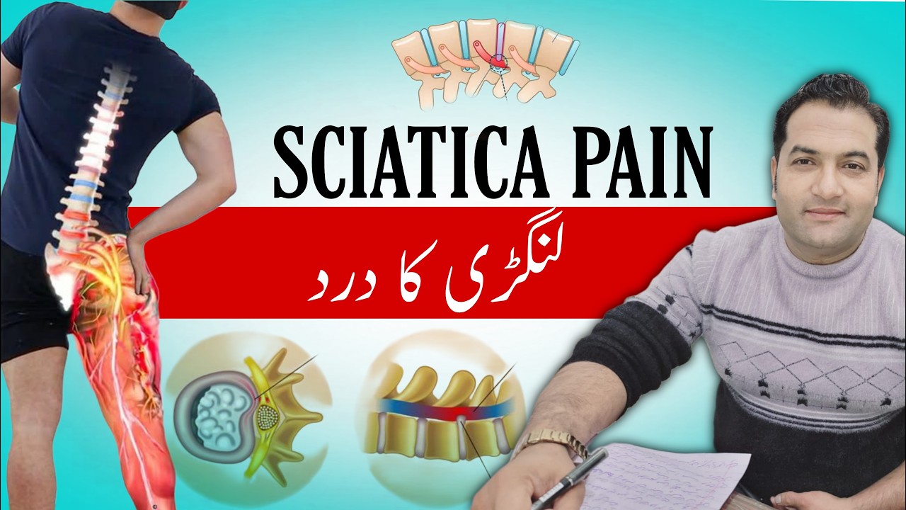 What Is Sciatica? Causes, Symptoms and Best Treatment for Leg Pain | Say Goodbye to Sciatica Pain