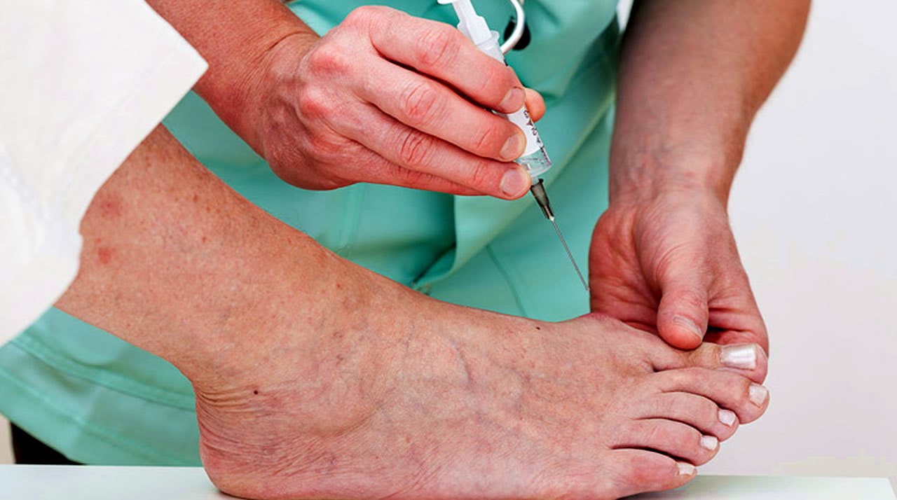 My Personal MD: Are Too Many Cortisone Injections Bad For You? | Podiatry
