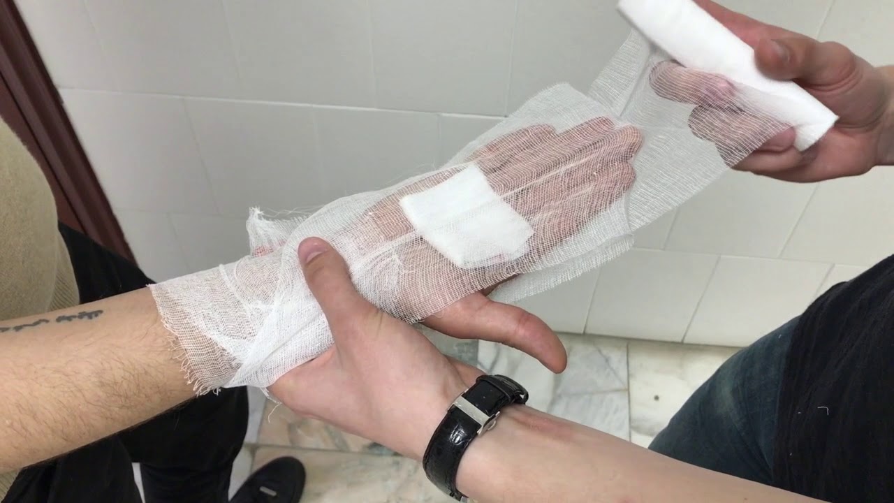 Mittens sarğı