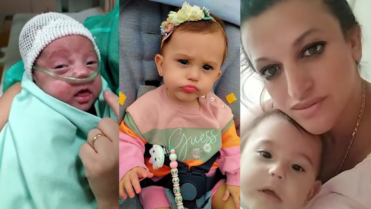 Bebi 300 gram i nënës laçjane sfidon mjekët. Lindi në muajin e 5-të, bebi i bie mamisë nga dora