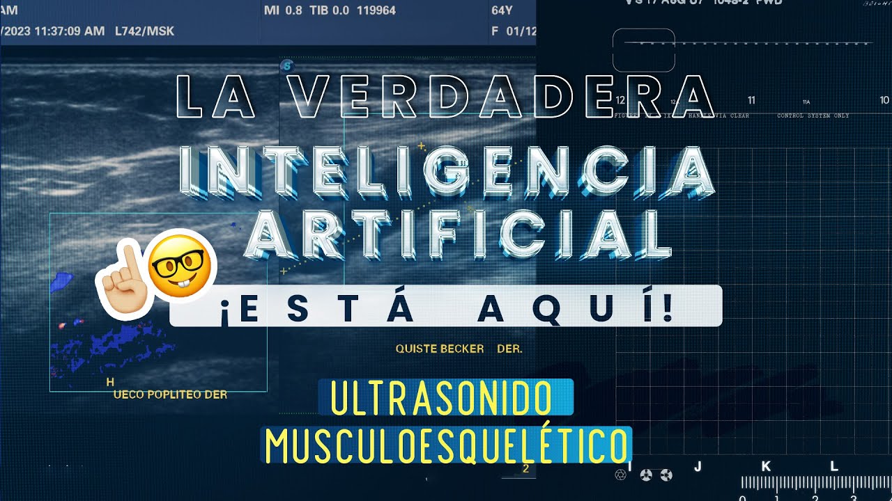 La verdadera Inteligencia Artificial | Ultrasonido P60 SonoScape | S-MSK Musculoesquelético