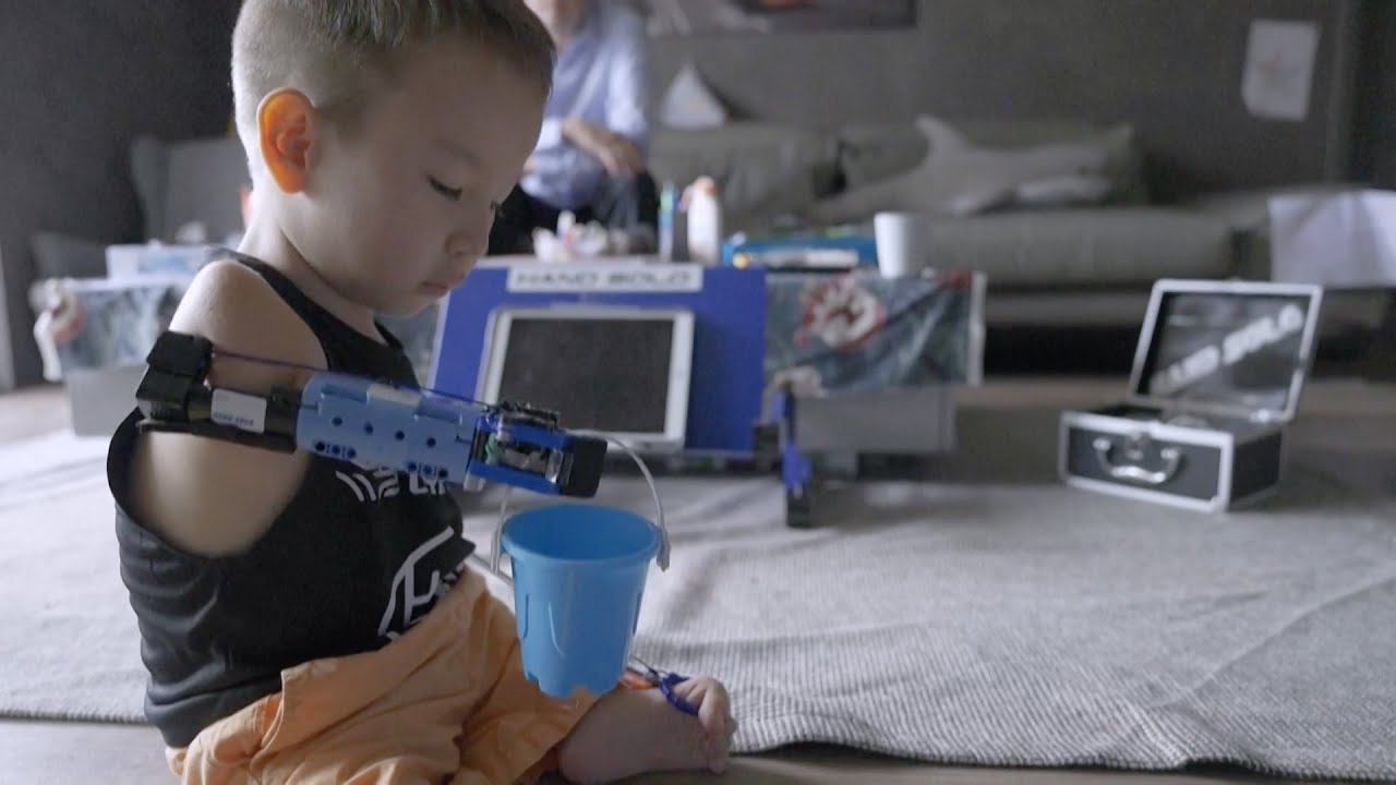 8-Year-Old Boy’s New Prosthetic Arm Made of Legos