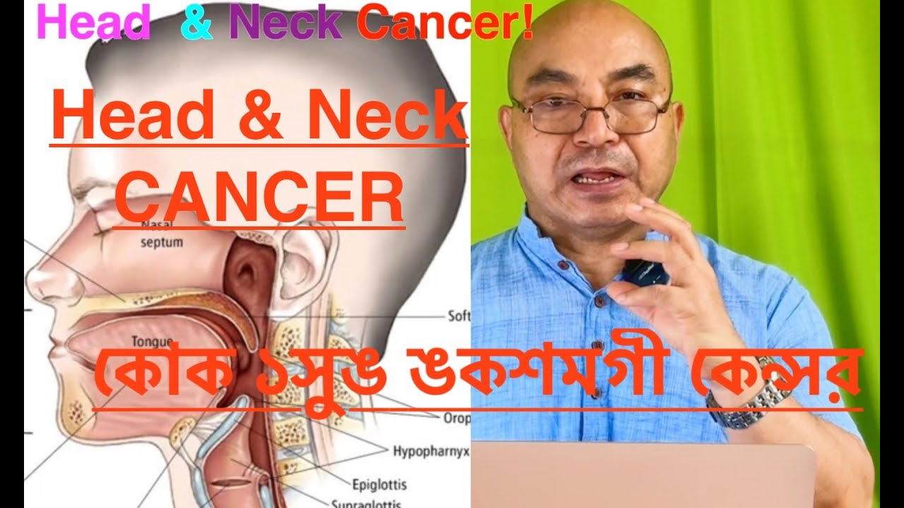 Head & Neck Cancer :: কোক ১সুঙ ঙকশমগী কেন্সর! Prevention & Early Treatment