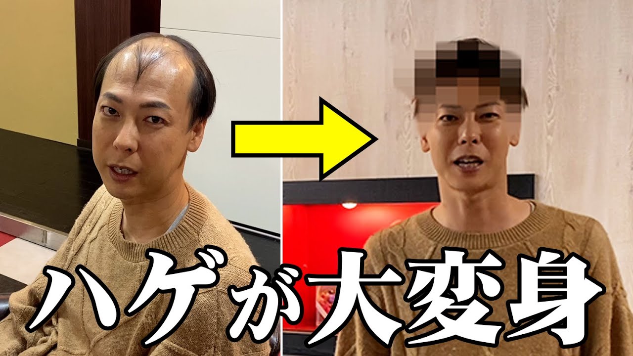 ハゲに朗報！竹之内が激推しする超軽量ウィッグが登場！